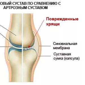 Сыворотка для СУСТАВОВ